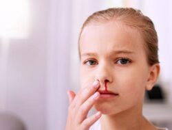 Arti Mimpi Hidung Mimisan Berdarah Pertanda dan Makan Apa Arti Mimpi Hidung Mimisan Berdarah Pertanda dan Makan Apa
