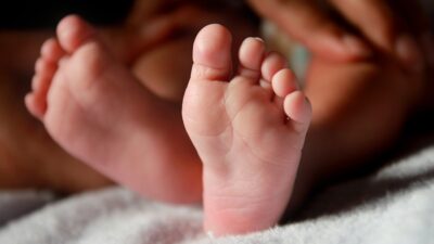 Arti Mimpi Kaki Bayi Melepuh Pertanda Buruk